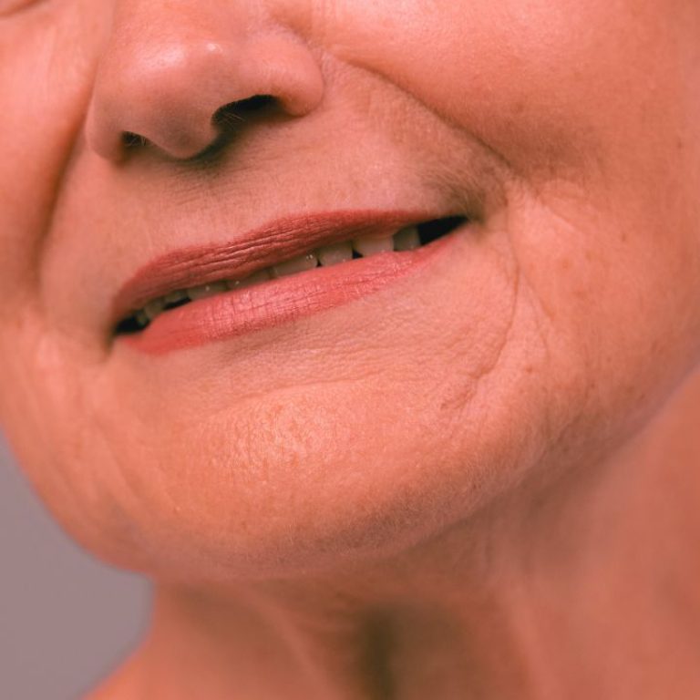 invecchiamento accelerato